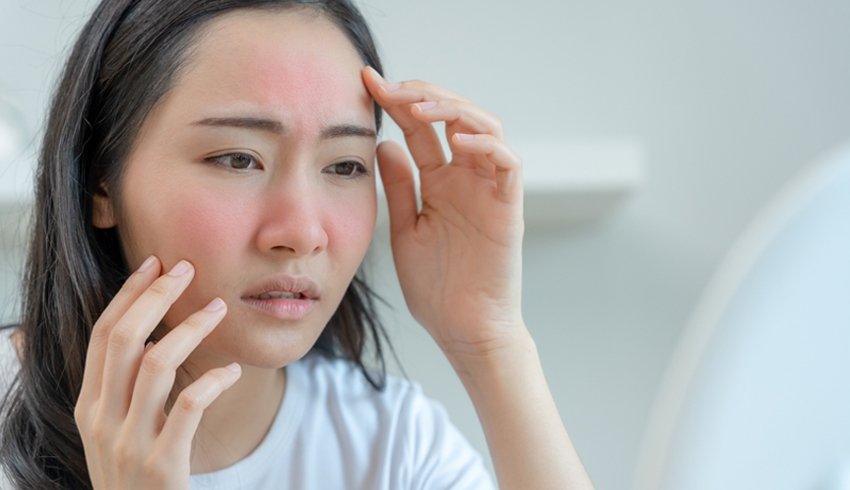 Rougeurs cutanées : pourquoi ma peau est-elle si tachée ?