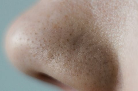 how to unclog clogged pores