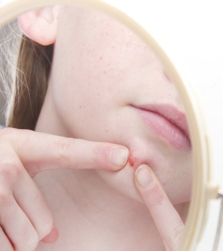 Dermatillomanie : tout ce que vous devez savoir sur le trouble de la peau