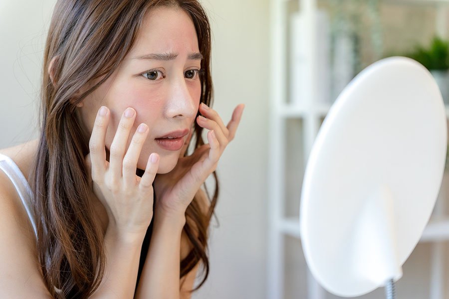 Une jeune femme asiatique s'inquiète des visages Dermatologie et allergique aux stéroïdes dans les cosmétiques.  peau sensible, visage rouge des coups de soleil, acné, allergie aux produits chimiques, éruption cutanée sur le visage.  problèmes de peau et beauté